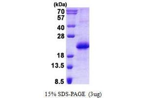Image no. 1 for CCHC-Type Zinc Finger, Nucleic Acid Binding Protein (CNBP) protein (His tag) (ABIN1098552)