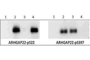 Western Blot of Rabbit anti-ARHGAP22 pS22 antibody.