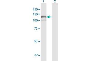 MAN2B1 antibody  (AA 1-1011)