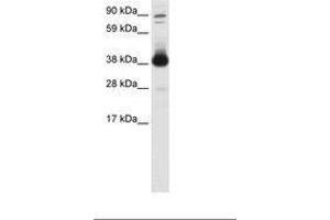 Image no. 1 for anti-Forkhead Box H1 (FOXH1) (AA 241-290) antibody (ABIN6736080)