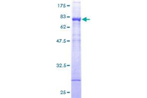 NADK Protein (AA 1-446) (GST tag)