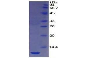 SDS-PAGE of Protein Standard from the Kit  (Highly purified E. (CD31 ELISA Kit)