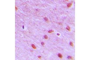 Immunohistochemistry (IHC) image for anti-Replication Factor C (Activator 1) 3, 38kDa (RFC3) (Center) antibody (ABIN7296830)