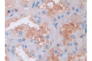 Detection of GAB1 in Human Kidney Tissue using Polyclonal Antibody to GRB2 Associated Binding Protein 1 (GAB1) (GAB1 antibody  (AA 394-656))