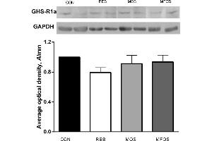 Gene expression of ghrelin in hypothalamus of calves. (GHRPR/Ghrelin Receptor/GHS-R1 (AA 75-135) antibody)