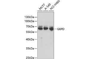 Western blot analysis of extracts of various cell lines, using G6PD antibody (ABIN6131014, ABIN6140863, ABIN6140864 and ABIN6218178) at 1:1000 dilution. (Glucose-6-Phosphate Dehydrogenase antibody  (AA 246-545))