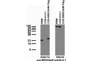 anti-ADP Ribosylation Factor Like GTPase 6 (ARL6) (AA 1-186) antibody
