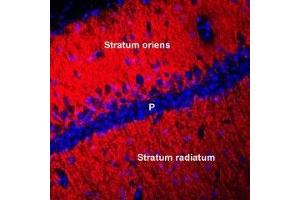 Expression of Connexin-45 in rat hippocampusImmunohistochemical staining of perfusion-fixed frozen mouse brain sections using Anti-Connexin-45 (GJC1) Antibody (ABIN7043207, ABIN7044085 and ABIN7044086), (1:400), followed by anti-rabbit-Cy3 antibody. (Gap Junction Protein, gamma 1, 45kDa (GJC1) Peptide)