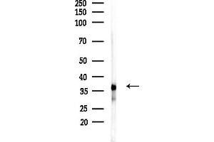 anti-Wingless-Type MMTV Integration Site Family, Member 8A (WNT8A) (Internal Region) antibody
