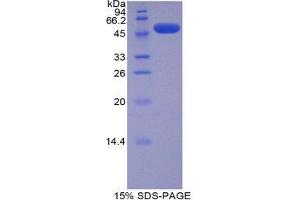 SDS-PAGE (SDS) image for Solute Carrier Family 27 (Fatty Acid Transporter), Member 5 (SLC27A5) (AA 471-689) protein (His tag,GST tag) (ABIN1879401)