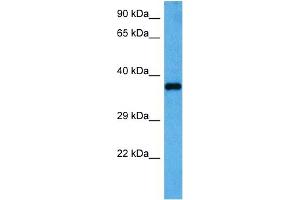 Host:  Rabbit  Target Name:  GAPDH  Sample Tissue:  Mouse Heart  Antibody Dilution:  1ug/ml (GAPDH antibody  (Middle Region))