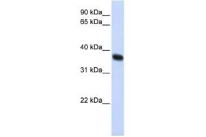 ZNF364 antibody used at 1 ug/ml to detect target protein. (RNF115 antibody  (C-Term))