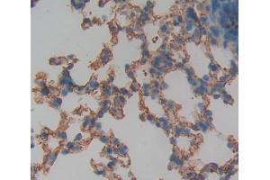 IHC-P analysis of lung tissue, with DAB staining. (Protein phosphatase 1 (AA 433-636), (Regulatory Subunit 15A) antibody)