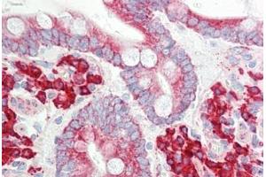 Human Small Intestine: Formalin-Fixed, Paraffin-Embedded (FFPE) (ETFA antibody  (AA 276-304))