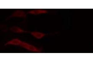 ABIN6274383 staining HuvEc cells by IF/ICC. (DGKD antibody  (N-Term))