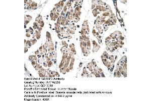Rabbit Anti-ITGB1BP2 Antibody  Paraffin Embedded Tissue: Human Muscle Cellular Data: Skeletal muscle cells Antibody Concentration: 4. (ITGB1BP2 antibody  (N-Term))