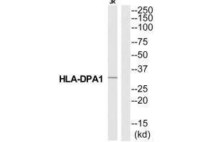 Western blot analysis of extracts from Jurkat cells, using HA2Q antibody. (HLA-DPA1 antibody  (N-Term))