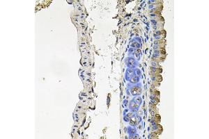 Immunohistochemistry of paraffin-embedded mouse lung using NDUFA6 antibody. (NDUFA6 antibody)