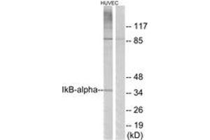 Western blot analysis of extracts from HuvEc cells, treated with TNF-alpha 20ng/ml 30', using IkappaB-alpha (Ab-42) Antibody. (NFKBIA antibody  (AA 9-58))