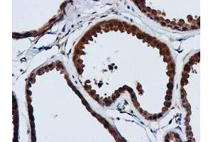 Immunohistochemical staining of paraffin-embedded Human breast tissue using anti-GATM mouse monoclonal antibody. (GATM antibody)