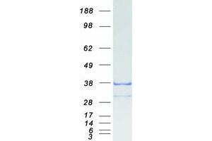 Validation with Western Blot (GID4 Protein (Myc-DYKDDDDK Tag))