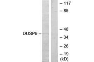 Western blot analysis of extracts from HeLa cells, using DUSP9 Antibody. (DUSP9 antibody  (AA 151-200))