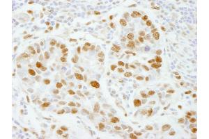 Immunohistochemistry (IHC) image for anti-Polymerase (DNA Directed), epsilon 3 (p17 Subunit) (POLE3) (AA 97-147) antibody (ABIN7448733) (POLE3 antibody  (AA 97-147))