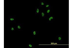 Image no. 2 for anti-CSE1 Chromosome Segregation 1-Like (CSE1L) (AA 872-972) antibody (ABIN465994) (Exportin 2 antibody  (AA 872-972))