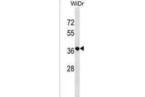 RN3L1 Antibody (C-term) (ABIN1537047 and ABIN2838093) western blot analysis in WiDr cell line lysates (35 μg/lane). (RN3L1 (AA 286-312), (C-Term) antibody)