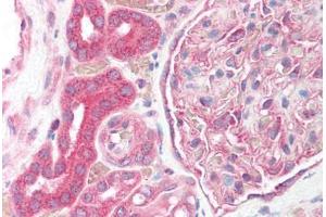 Immunohistochemistry (IHC) image for anti-Hypoxia Inducible Factor 1, alpha Subunit (Basic Helix-Loop-Helix Transcription Factor) (HIF1A) (AA 833-850) antibody (ABIN1901934)
