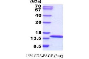SDS-PAGE (SDS) image for Cystatin A (Stefin A) (CSTA) (AA 1-98) (Active) protein (His tag) (ABIN6387718) (CSTA Protein (AA 1-98) (His tag))