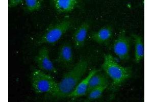 Detection of CRYaB in Human U2OS Cell using Polyclonal Antibody to Crystallin Alpha B (CRYaB) (CRYAB antibody  (AA 1-175))
