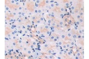 Detection of MYL3 in Mouse Kidney Tissue using Polyclonal Antibody to Myosin Light Chain 3, Alkali, Ventricular, Slow Skeletal (MYL3) (MYL3/CMLC1 antibody  (AA 8-199))