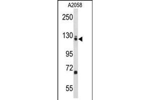 Western blot analysis of EFTUD2 Antibody in A2058 cell line lysates (35ug/lane) (EFTUD2 antibody  (AA 257-284))