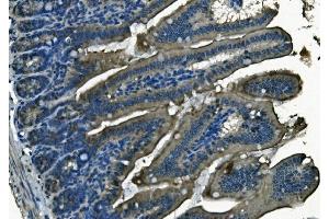 IHC analysis of PI-16/PI16 using anti-PI-16/PI16 antibody (ABIN7601074). (PI16 antibody  (AA 28-363))