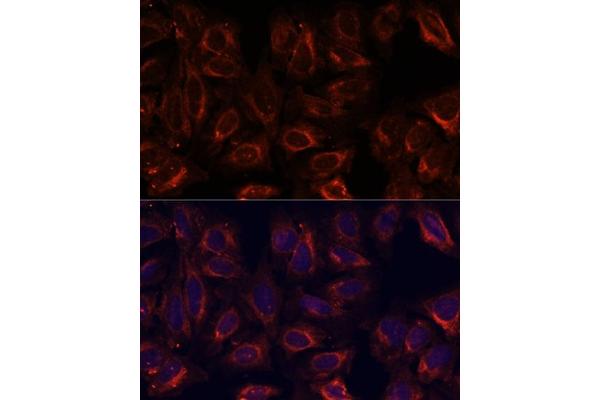 SCGB3A2 antibody  (AA 1-93)