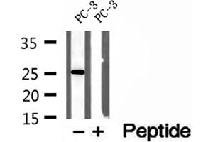 Western blot analysis of extracts of PC-3 cells, using OIP5 antibody.