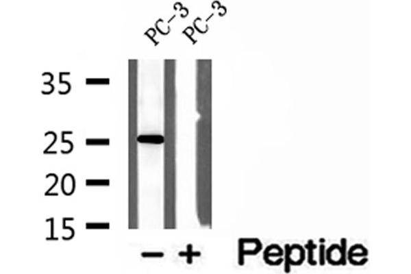 OIP5 antibody  (C-Term)