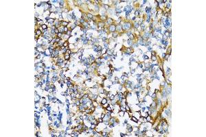 Immunohistochemistry of paraffin-embedded human tonsil using NFKB1 antibody (ABIN5998332) at dilution of 1/100 (40x lens). (NFKB1 antibody)