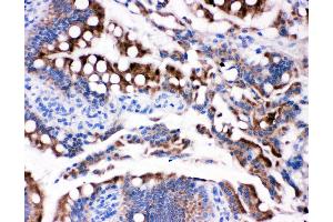 Anti-HSD17B2 antibody,  IHC(P) IHC(P): Rat Intestine Tissue (HSD17B2 antibody  (C-Term))