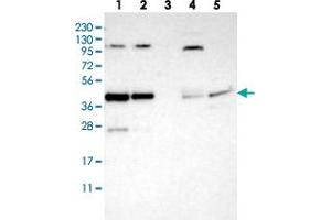 Western blot analysis of Lane 1: RT-4, Lane 2: U-251 MG, Lane 3: Human Plasma, Lane 4: Liver, Lane 5: Tonsil with CCDC104 polyclonal antibody  at 1:250-1:500 dilution. (CCDC104 antibody)