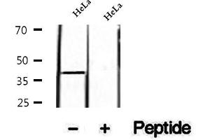 anti-AKT1 Substrate 1 (Proline-Rich) (AKT1S1) (pSer183) antibody