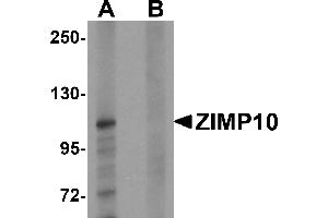 Western blot analysis of ZIMP10 in K562 cell lysate with ZIMP10 antibody at 0.