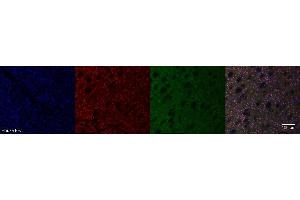 Immunohistochemistry (IHC) image for anti-ISL LIM Homeobox 1 (ISL1) antibody (ABIN7456087) (ISL1 antibody)