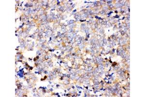IHC analysis of IKKA using anti-IKKA antibody (ABIN3043812).