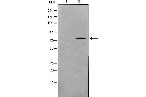 Western blot analysis on HeLa cell lysate using GK2 Antibody，The lane on the left is treated with the antigen-specific peptide. (GK2 antibody  (Internal Region))