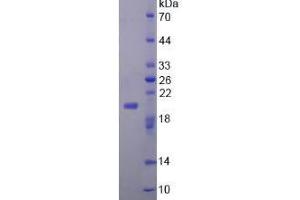 SDS-PAGE (SDS) image for Fibroblast Growth Factor 22 (FGF22) (AA 26-162) protein (His tag) (ABIN4989621)