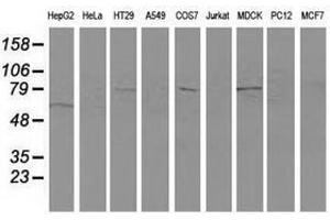 Image no. 2 for anti-Vascular Cell Adhesion Molecule 1 (VCAM1) antibody (ABIN1497154) (VCAM1 antibody)