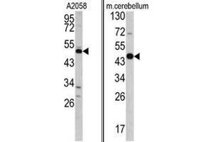 (LEFT) Western blot analysis of GAS7 antibody (C-term) in A2058 cell line lysates (35 µg/lane). (GAS7 antibody  (C-Term))