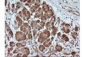 Image no. 2 for anti-Parvin, alpha (PARVA) antibody (ABIN1496444) (Parvin alpha antibody)